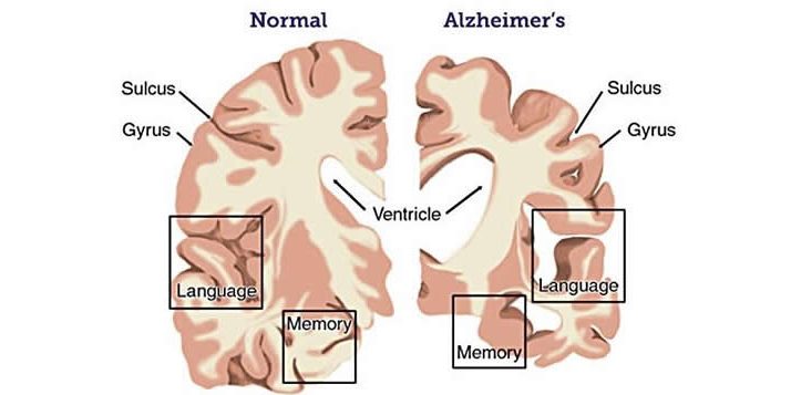 Brain_Cross-Sections _3_